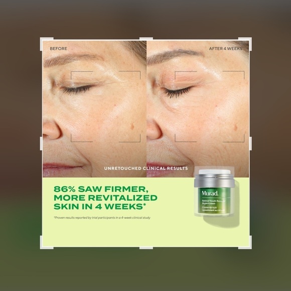 New Murad Retinol Youth Renewal Night Cream - Picture 6 of 8